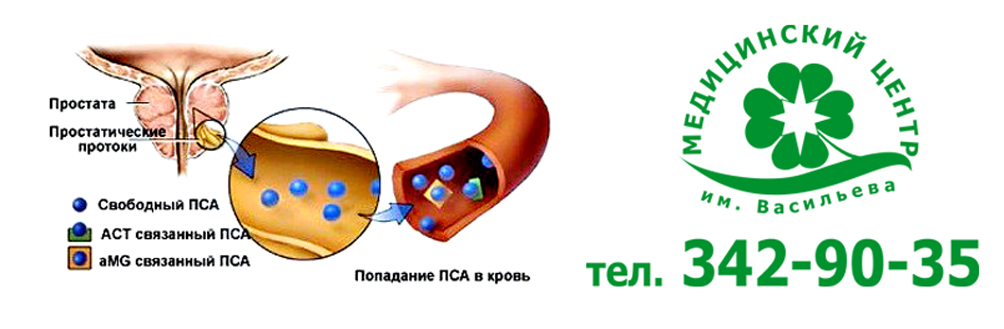 Пса анализ нижний новгород