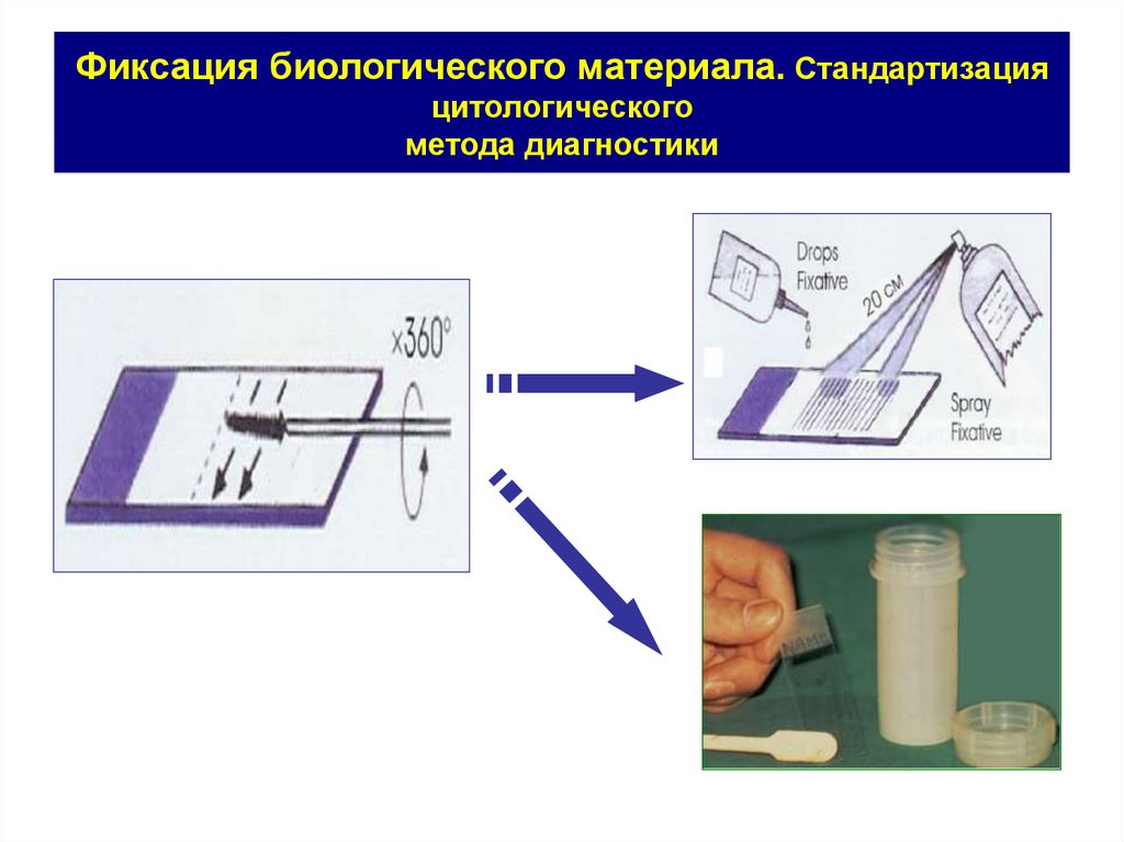 Процесс фиксации. Цитологический метод диагностики. Материал для цитологического исследования. Фиксация биоматериала. Способы получения цитологического материала.