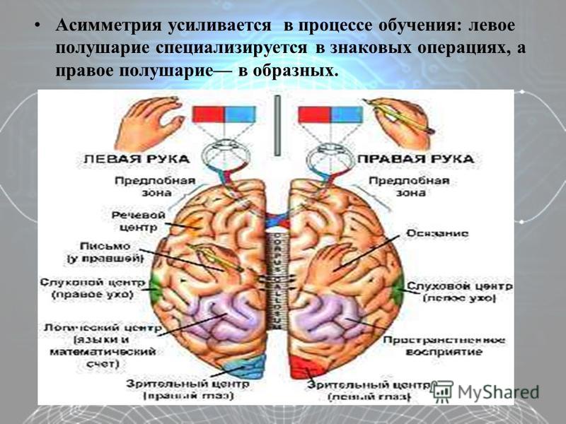 Функциональная асимметрия мозга картинки