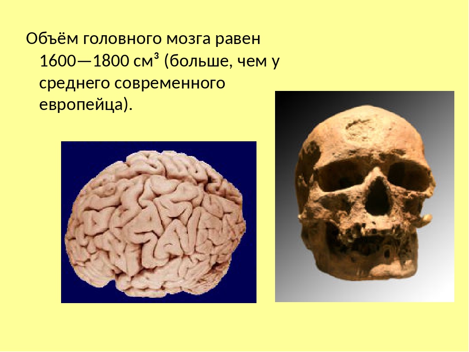 Объем головного мозга наибольшее. Объем головного мозга. Объем головного мозга современного человека. Объем головного мозга наибольший у. Объем мозга 1800.