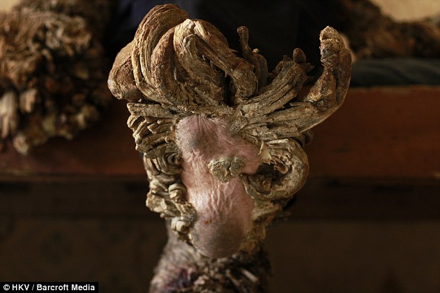 He died late last month of a complicated series of health problems, including hepatitis, liver and gastric disorders, doctors said. Pictured is one of his feet on December 10