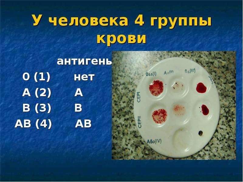 Сколько процентов крови 4. Группы крови человека. 4 Группа крови. Четвертая группа крови цвет. Цвет 3 группы крови.