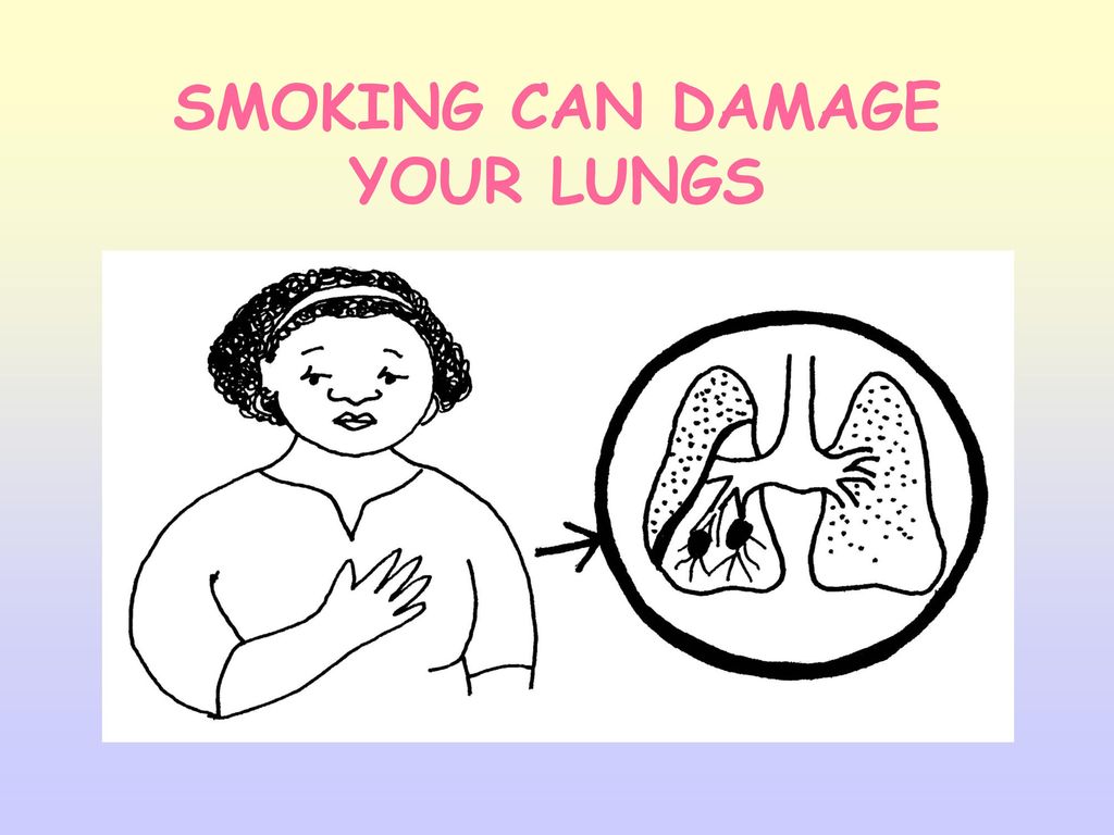 SMOKING CAN DAMAGE YOUR LUNGS