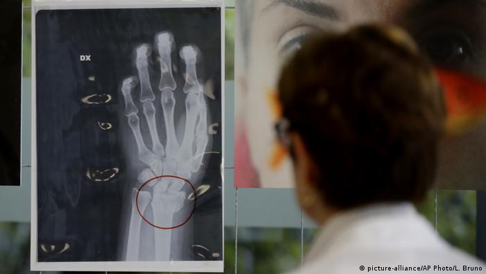 x-ray showing a left hand (picture-alliance/AP Photo/L. Bruno)